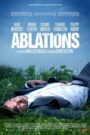 Ablations